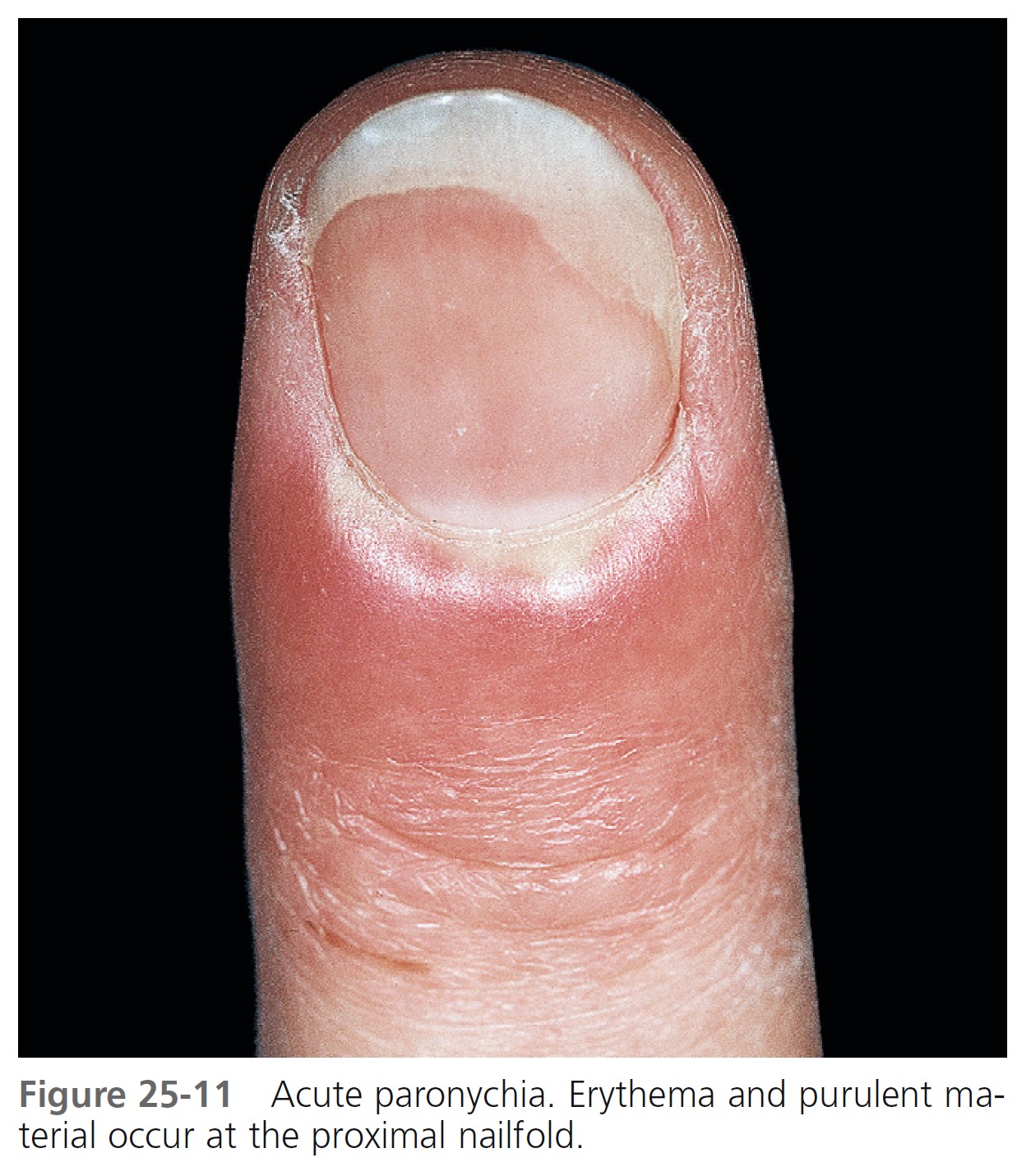 Nail biology and nail science - De Berker - 2007 - International Journal of  Cosmetic Science - Wiley Online Library