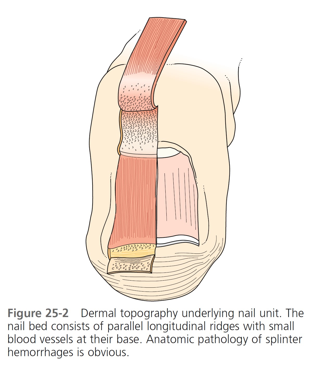 Figure 2 from Lateral nail fold Distal edge of nail plate Anterior ligament  Lunula Cuticle Eponychium Nail matrix Cuticle Nail bed Nail plate Distal  nail fold Posterior ligament Eponychium Nail plate |