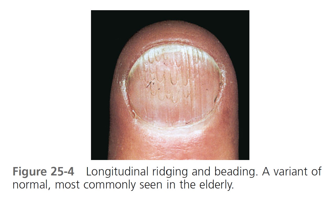 Study of Nail Disorders in Dermatology