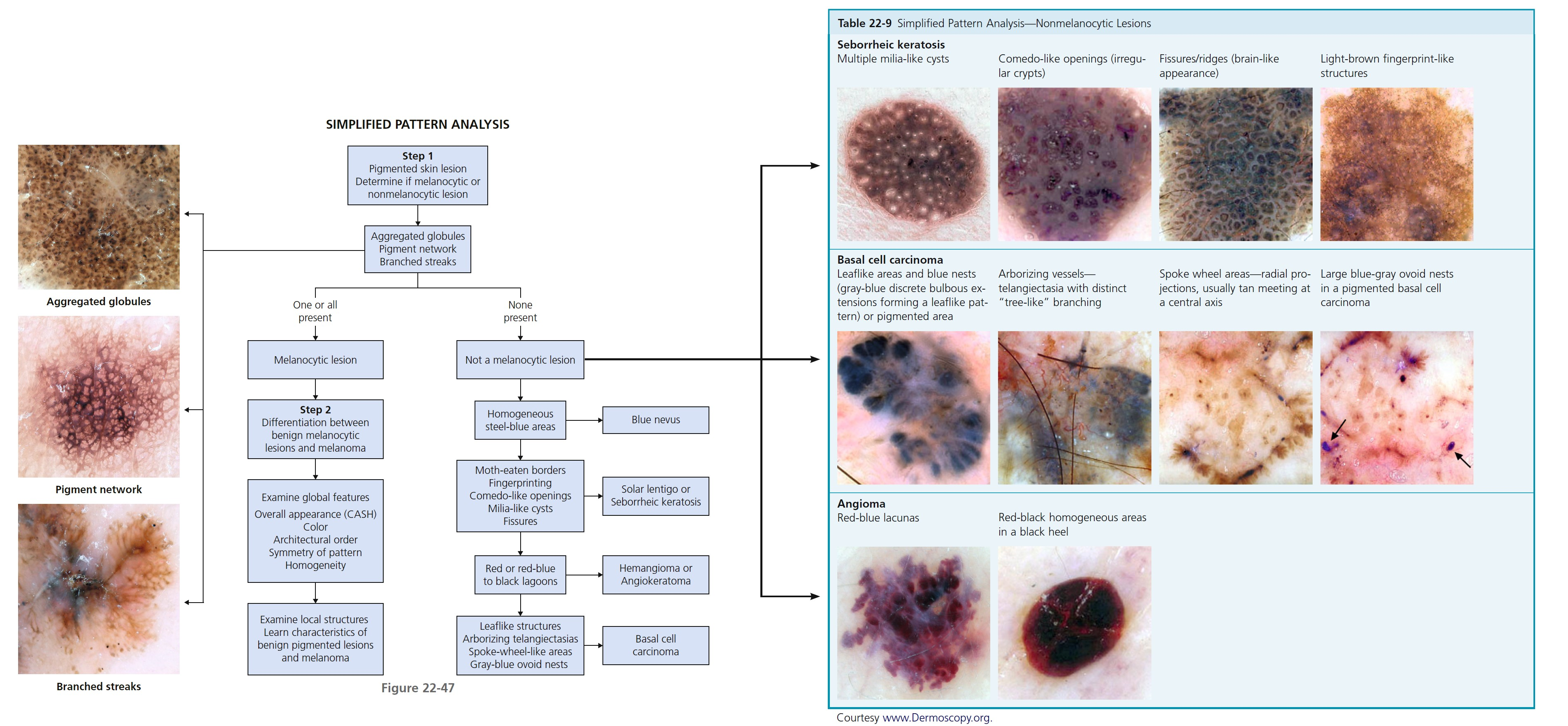 Figure 22 47 & Table 22 9