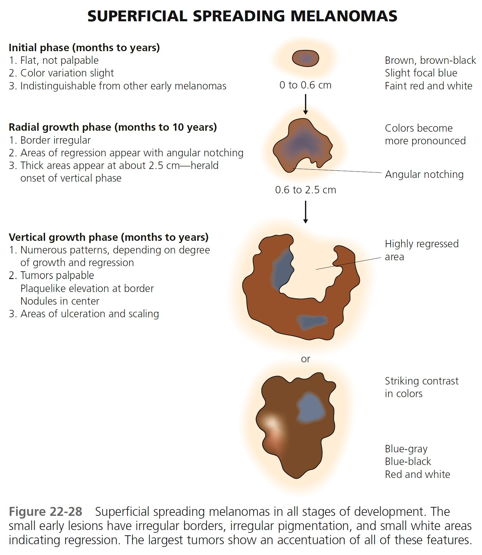 Figure 22 28