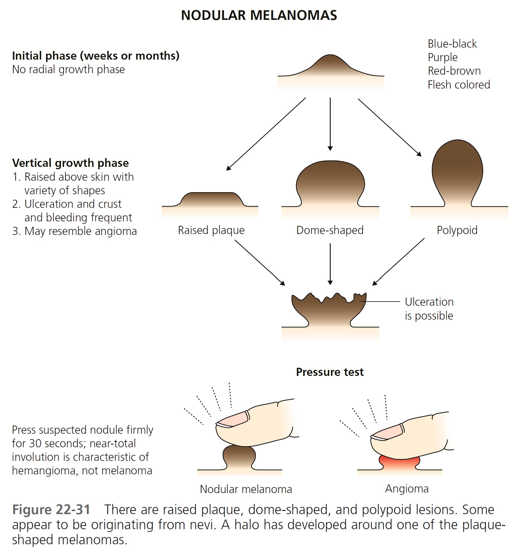 Figure 22 31