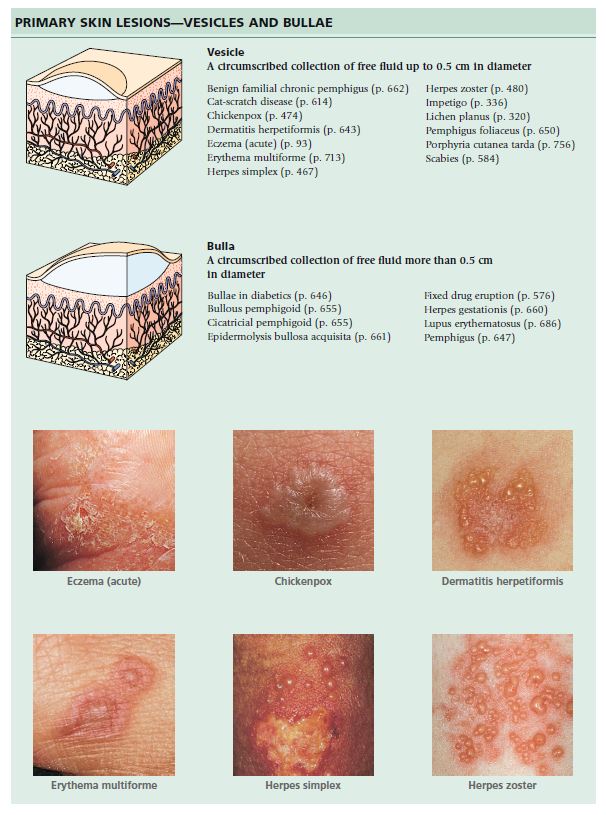 Diagnosis of skin disease