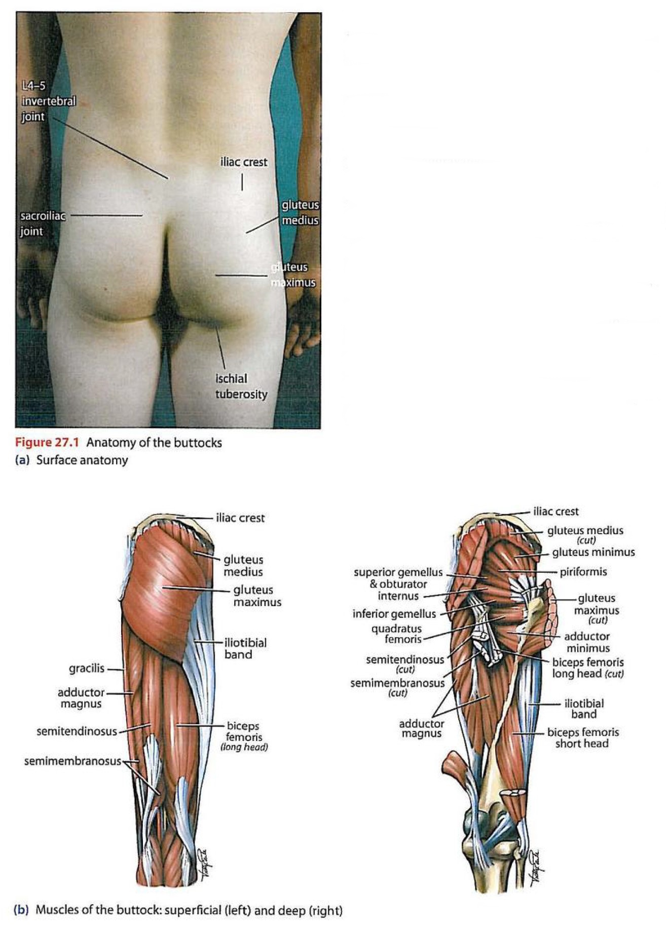 Buttock pain